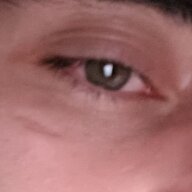 Choque