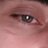 Choque